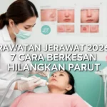 Rawatan Jerawat 2026: 7 Cara Berkesan Hilangkan Parut